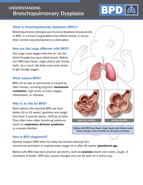 Bronchopulmonary Dysplasia (BPD) - NICU Parent Education ...