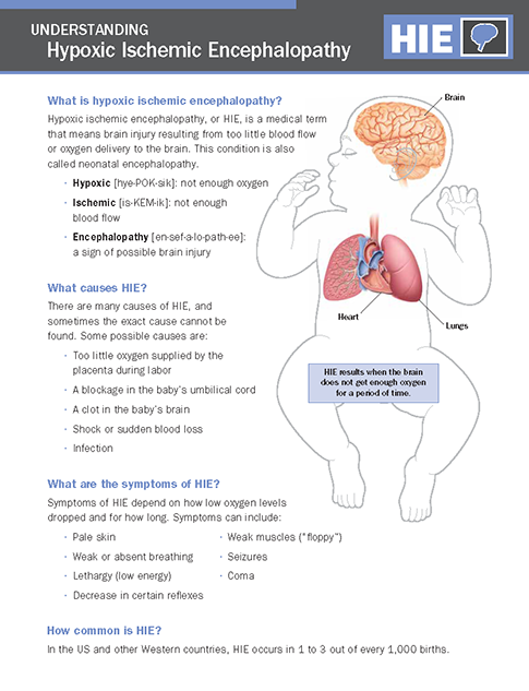 Hypoxic Ischemic Encephalopathy (HIE) - NICU Parent Education Resources