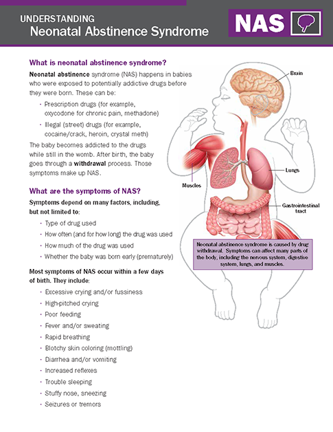 Neonatal Abstinence Syndrome (NAS) - NICU Parent Education Resources